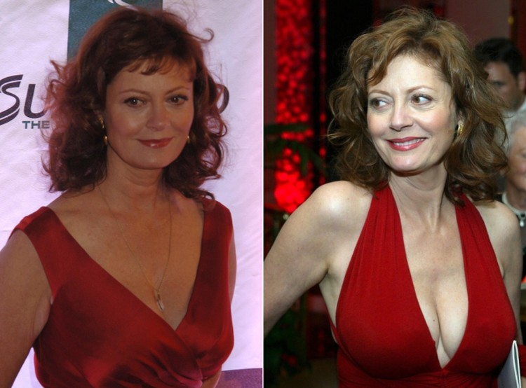 Susan Sarandon before and after boob job.