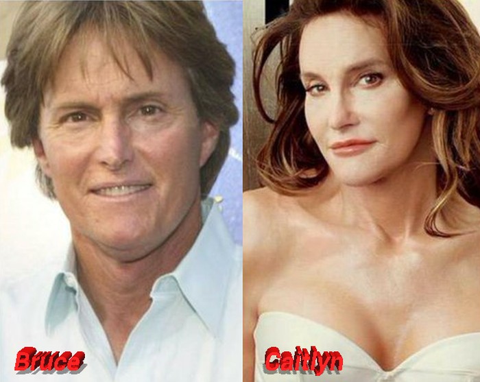 Bruce Jenner Plastic Surgery From Male Athlete To Female Star