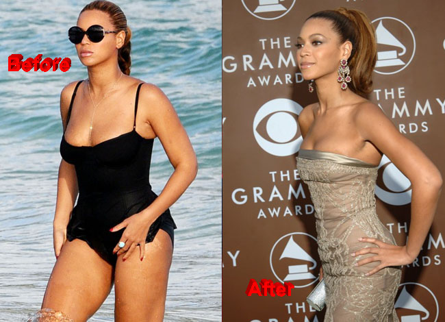 Beyoncé Plastic Surgery before and after 1