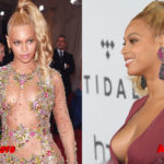 Beyoncé breasts Plastic Surgery