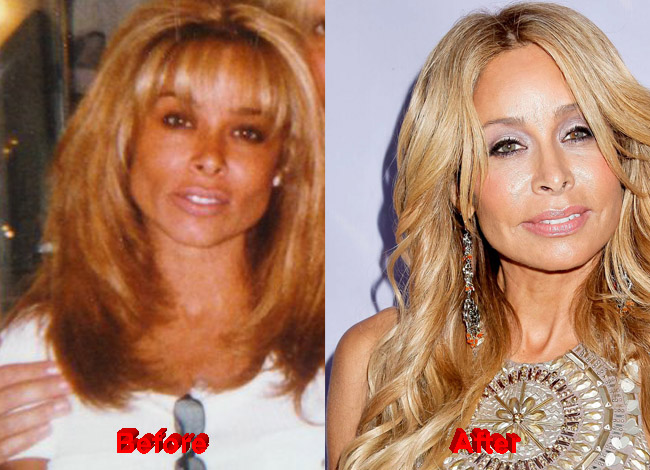 Faye Resnick Plastic Surgery before after nose job
