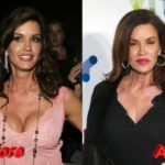 Janice Dickinson before and after plastic surgery