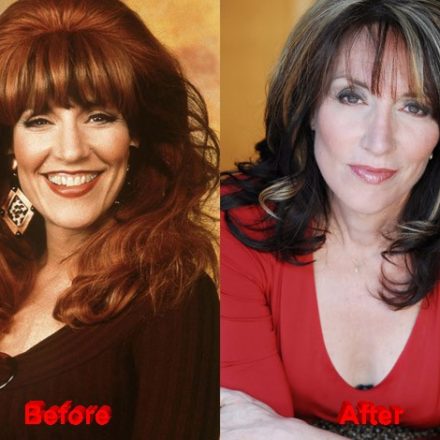 Katey Sagal Plastic Surgery Rumors?