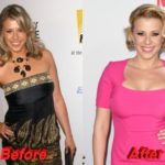 Jodie Sweetin before and after plastic surgery