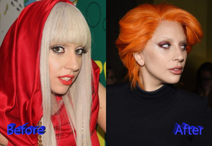 Lady Gaga Nose Job Before and After