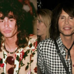 Steven Tyler Before and After Cosmetic Surgery