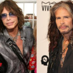 Steven Tyler Before and After Surgery Transformation