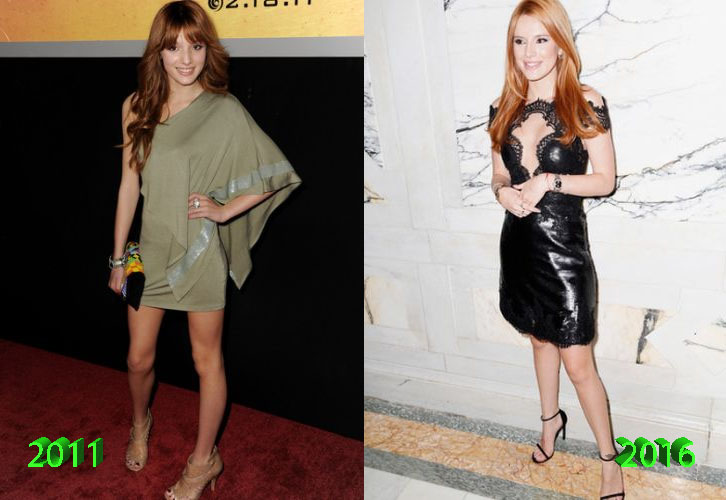 Bella Thorne Before and After Cosmetic Surgery.