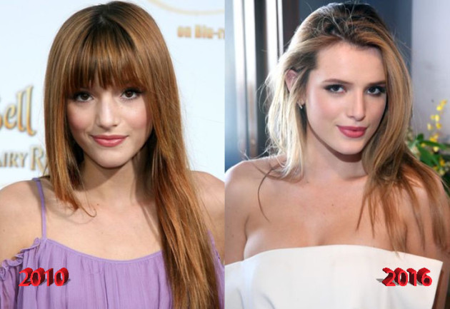 Bella Thorne Plastic Surgery: A Good Idea?