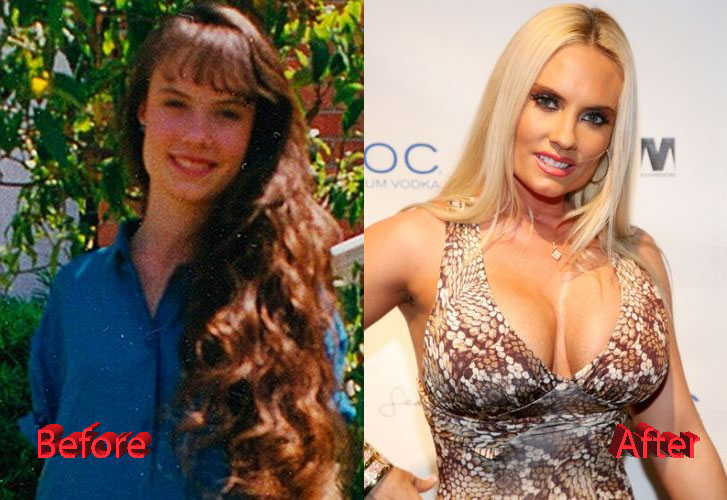 Coco Austin Plastic Surgery Before and After