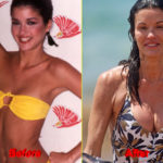 Janice Dickinson Plastic Surgery before after boobs
