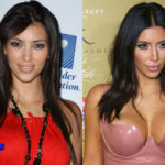 Kim Kardashian Plastic Surgery Before and After