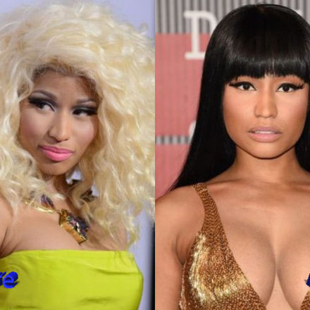 Nicki Minaj Plastic Surgery Procedures