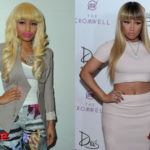 Nicki Minaj Plastic Surgery Before and After