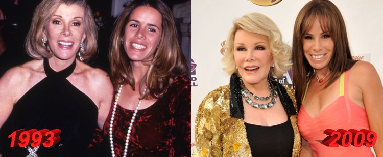 Joan Rivers and Melissa Rivers Plastic Surgery Before and After
