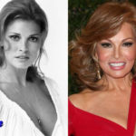 Raquel Welch Before and After Cosmetic Surgery