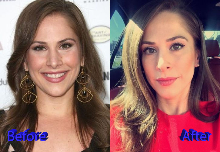 Ana Kasparian Plastic Surgery Before and After