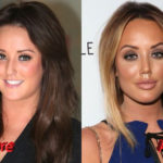 Charlotte Crosby Before and After Nose Job Surgery