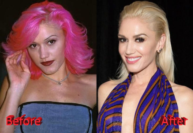 Gwen Stefani Plastic Surgery Then And Now 5576