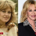 Melanie Griffith Plastic Surgery Before and After