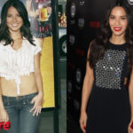 Olivia Munn Before and After Cosmetic Procedure