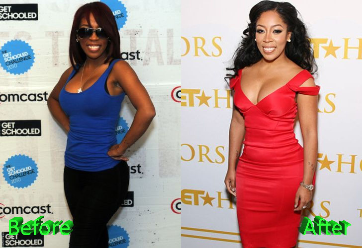 K Michelle Before and After Butt Implants