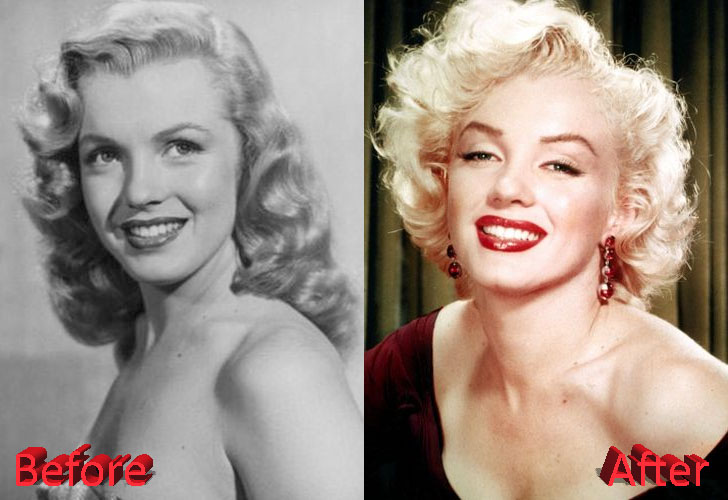 Marilyn Monroe Before and After Cosmetic Surgery
