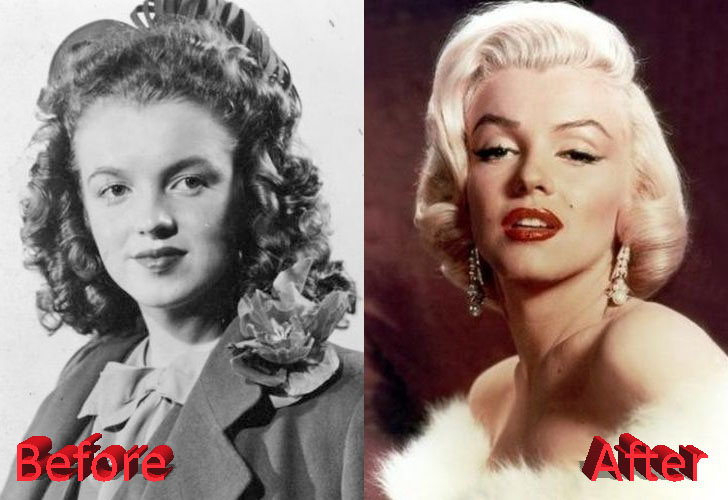 Marilyn monroe plastic surgery