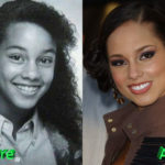 Alicia Keys Before and After Cosmetic Surgery