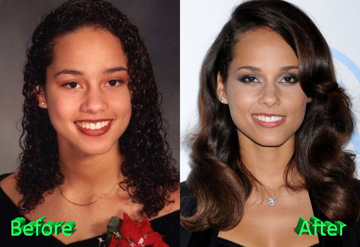 Alicia Keys Nose Job Before and After