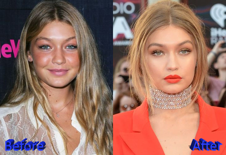 gigi hadid before and after