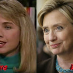 Hillary Clinton before and after cosmetic procedure