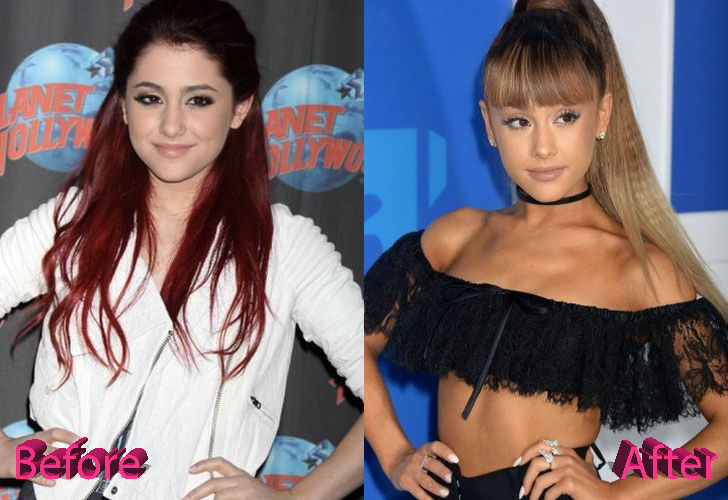 ariana-grande-plastic-surgery-before-and-after