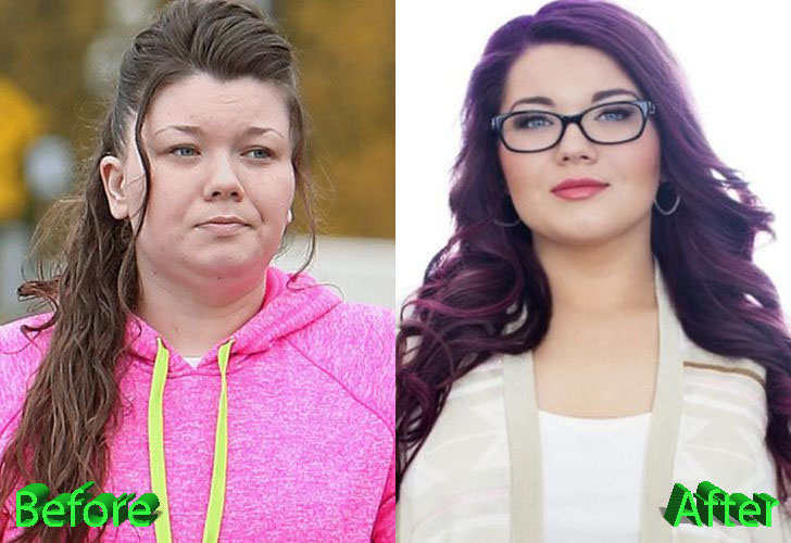 Amber Portwood Before and After Cosmetic Surgery