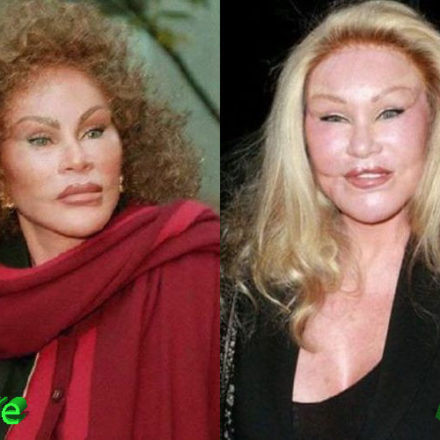 Catwoman Plastic Surgery From Bad To Worse