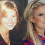 Christina El Moussa Before and After Cosmetic Surgery