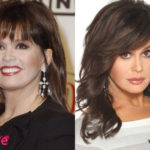 Marie Osmond Plastic Surgery Before and After
