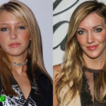 Katie Cassidy Before and After Cosmetic Surgery