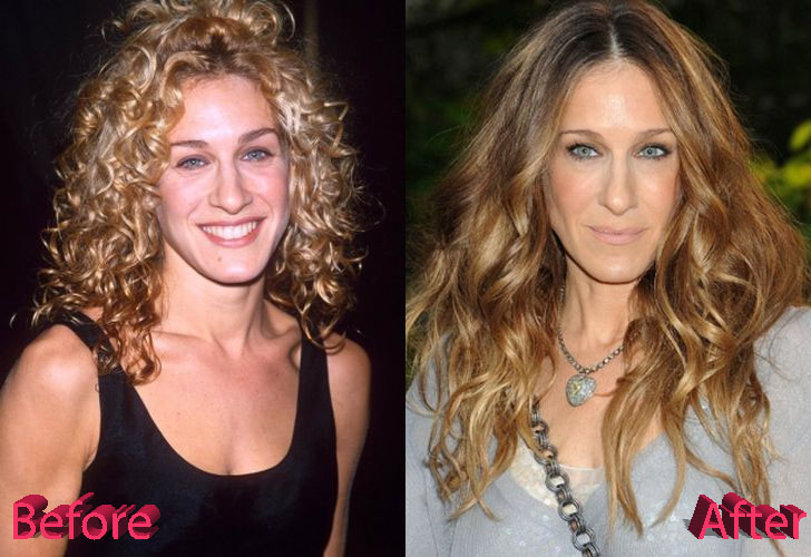Sarah Jessica Parker Before and After Rhinoplasty