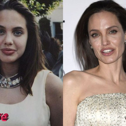 Angelina Jolie Plastic Surgery: Still a Beauty Icon