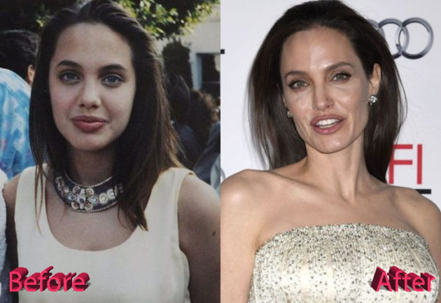 Angelina Jolie Plastic Surgery: Still A Beauty Icon