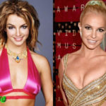 Britney Spears Plastic Surgery Before and After