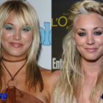 Kaley Cuoco Plastic Surgery Before and After