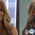 Holly Sonders before and after lip job plastic surgery