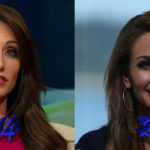 Holly Sonders before and after plastic surgery