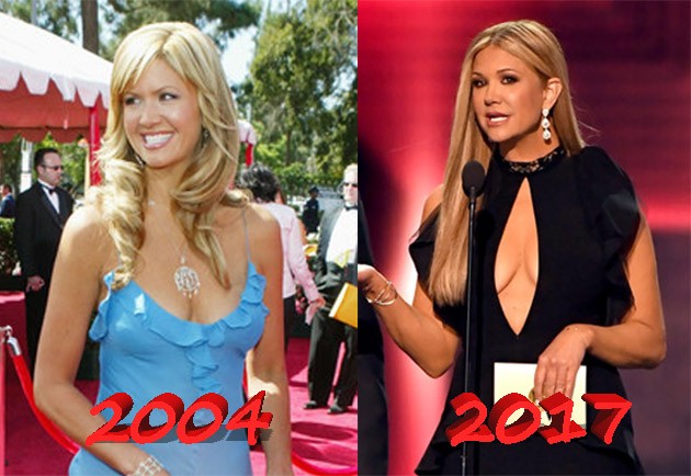 Nancy ODell breast plastic surgery before and after