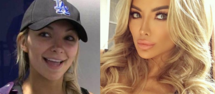 lindsey pelas plastic surgery before and after