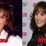 Robin McGraw Before and After