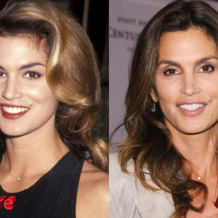 Cindy Crawford Plastic Surgery: Improved Look For The Fashion Icon