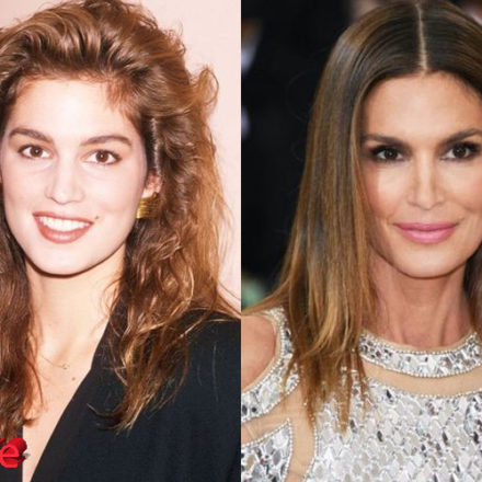 Cindy Crawford Plastic Surgery: Improved Look For The Fashion Icon